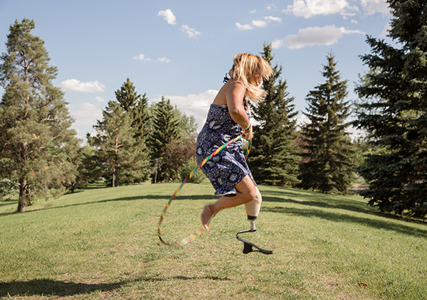 A woman with a prosthetic foot jumping with a hula hoop