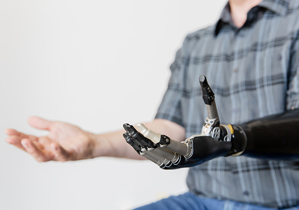 A man with one hand and one prosthetic hand 